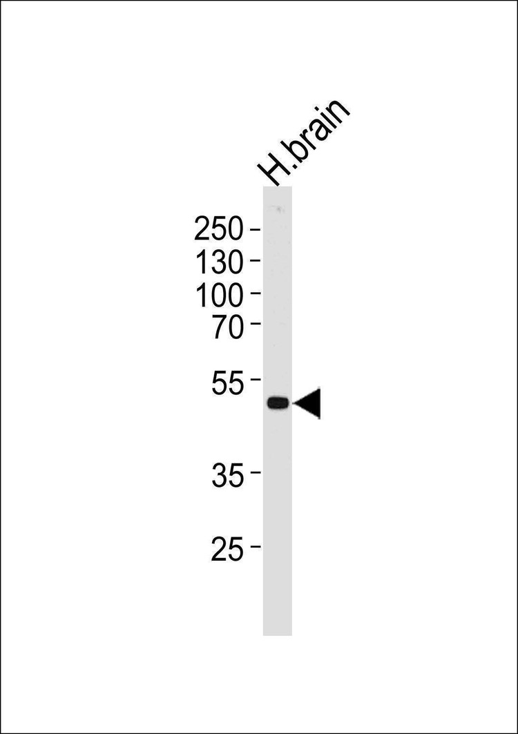 Anti-KCNJ12 (C-term) Antibody