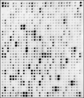 Human Proteome Profiling Array L4000 (Membrane)