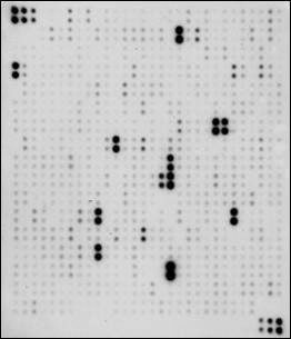 Human Proteome Profiling Array L4000 (Membrane)