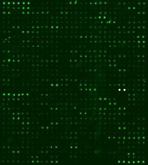 Human Proteome Profiling Array L4000 (Glass Slide)