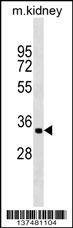 Anti-ZFP36L2 (Center) Antibody