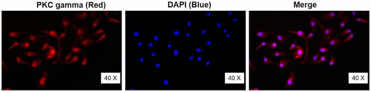 Anti-PKC gamma Antibody