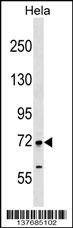 Anti-FIGNL1 (N-term) Antibody