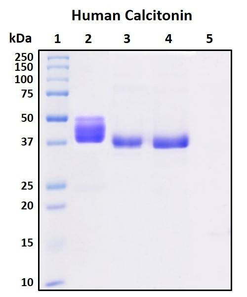 Recombinant Human Calcitonin (CT) Protein, Biotinylated