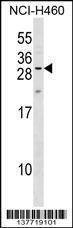 Anti-MPZL2 (Center) Antibody