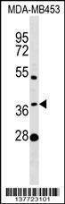 Anti-MTHFSD (N-term) Antibody