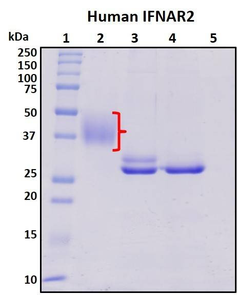 Recombinant Human IFN receptor2 Protein, Biotinylated