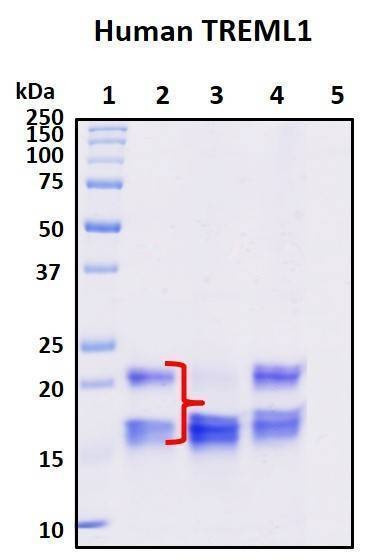 Recombinant Human TLT-1 (extracellular) Protein, Biotinylated