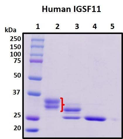 Recombinant Human IgSF11 (N-Terminal) Protein, Biotinylated