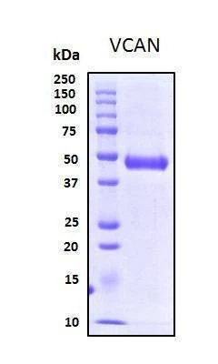 Recombinant Human Versican Protein, Biotinylated