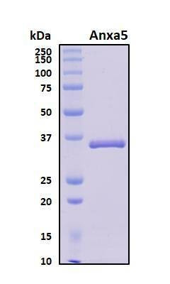 Recombinant Mouse Annexin A5 (Anxa5) Protein, Biotinylated