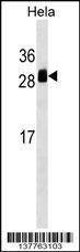 Anti-TMED1 (Center) Antibody
