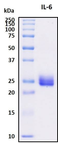 Recombinant Porcine (pig) IL-6 Protein, Biotinylated