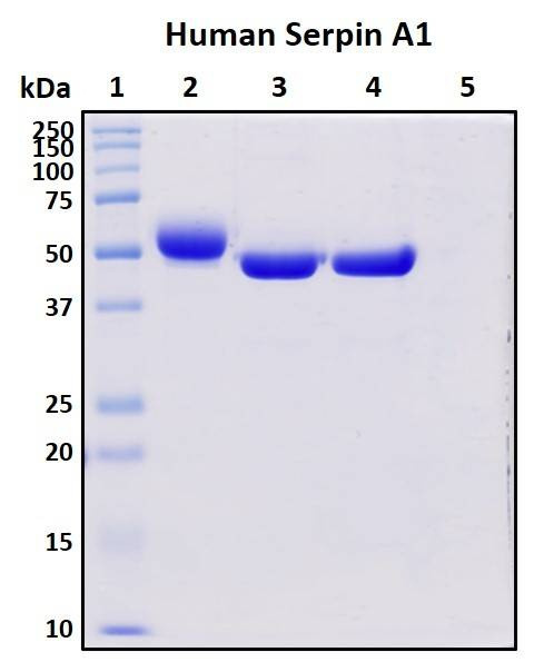 Recombinant Human Serpin A1 Protein, Biotinylated