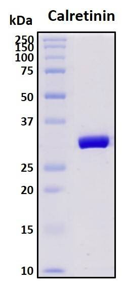 Recombinant Human Calretinin Protein, Biotinylated