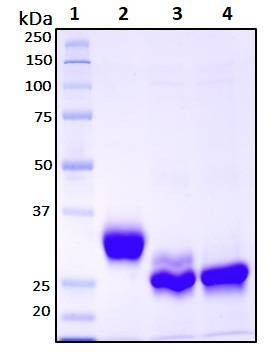 Recombinant SARS-CoV-2, S1 Subunit Protein (RBD), Biotinylated