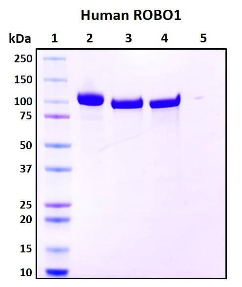 Recombinant Human ROBO1 Protein, N-terminal, Biotinylated