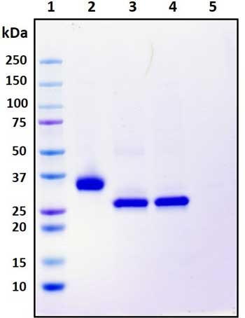 Recombinant SARS-CoV-2 S1 Subunit Protein (RBD), mutant N501Y, Biotinylated