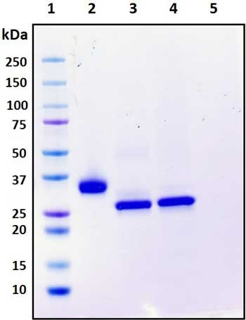 Recombinant SARS-CoV-2 S1 Subunit Protein (RBD), mutant Y453F, Biotinylated