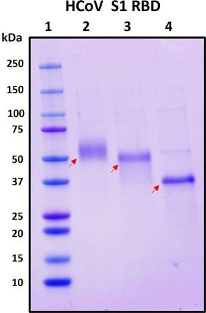 Recombinant HCov-HKU1 S1 subunit, RBD Protein, Biotinylated