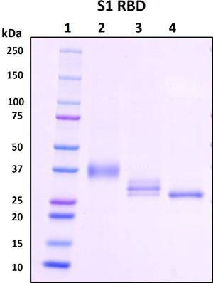 Recombinant MERS S1 Subunit Protein, RBD, Biotinylated