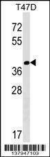 Anti-NTAN1 (C-term) Antibody