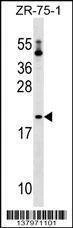 Anti-PTRH1 (Center) Antibody