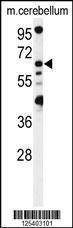 Anti-MON1B (C-term) Antibody