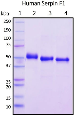 Recombinant Human Serpin F1 (PEDF) Protein