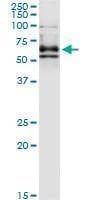 Anti-DPYSL4 Antibody