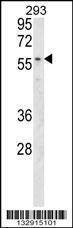 Anti-MBOAT2 (Center) Antibody