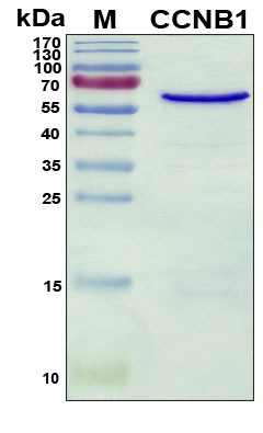 Recombinant Human Cyclin-B1 Protein