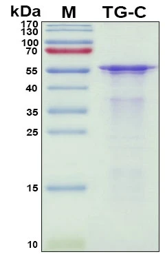 Recombinant Human Thyroglobulin, C-terminal Protein, Antigen Grade