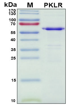 Recombinant Human Pyruvate Kinase (PKLR) Protein, Antigen Grade