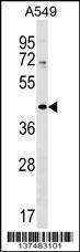 Anti-ZNF25 (N-term) Antibody