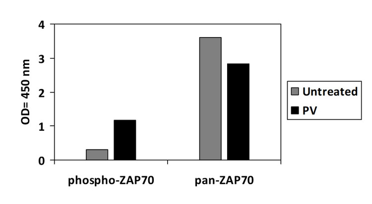 Human Phospho-ZAP70 (Y319) ELISA Kit