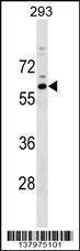 Anti-RASGEF1C (N-term) Antibody