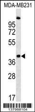 Anti-RQCD1 (Center) Antibody
