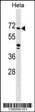 Anti-ZNF280B (N-term) Antibody