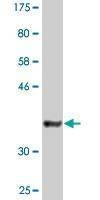 Anti-DTNBP1 Antibody