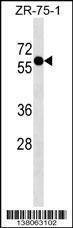 Anti-ZNF503 (N-term) Antibody