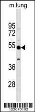 Anti-CALCRL (Center) Antibody