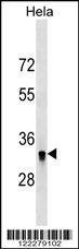 Anti-HIBADH (N-term) Antibody