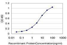 Anti-DTX3L Antibody