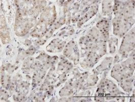 Anti-DTX3L Antibody