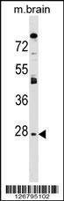Anti-AQP1 (C-term) Antibody