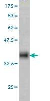 Anti-DUB3 Antibody