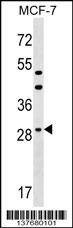 Anti-DHRS11 (Center) Antibody