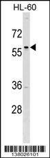 Anti-TFAP2D (C-term) Antibody