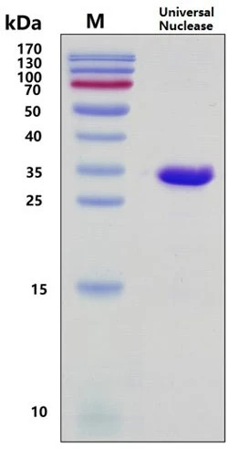 Universal Nuclease (DNase / RNase)